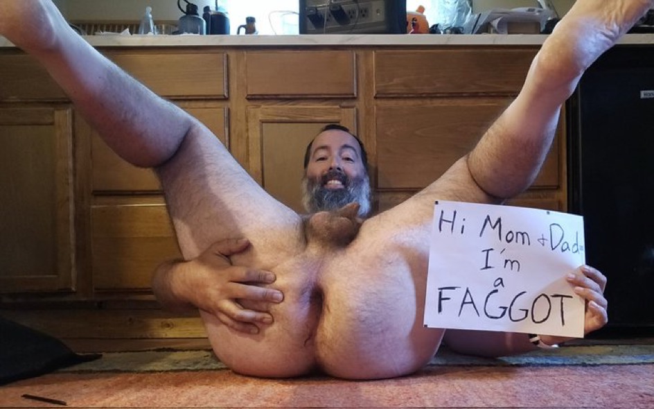 exposed